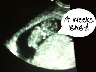 hình ảnh siêu âm thai nhi 14 tuần