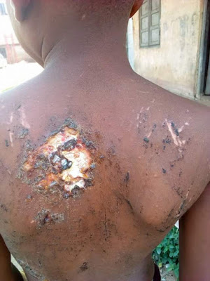  Photos: 12-year-old girl brutally flogged by her uncle in Delta State; doused with hot water then mutilated with razor blade