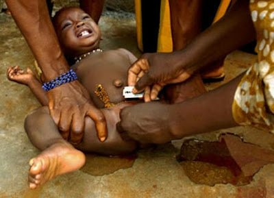 The Countless Dangers of Female Genital Mutilation By Alawa John