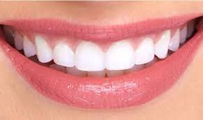 DENTAL CARE-TEETH WHTENING FOR YOU