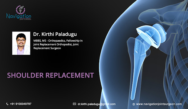 Best Shoulder Replacement Surgeon in Hyderabad
