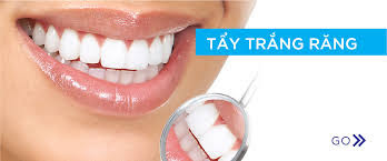  Tẩy trắng răng là gì? 