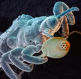 louse-and-egg_1757446i