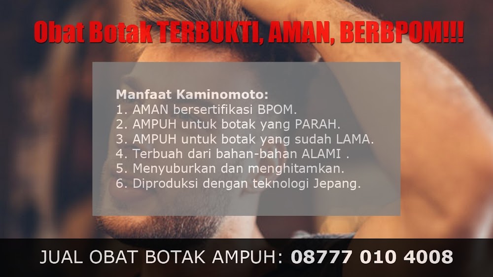 jual OBAT PENUMBUH RAMBUT BOTAK Padang Lawas<br/>