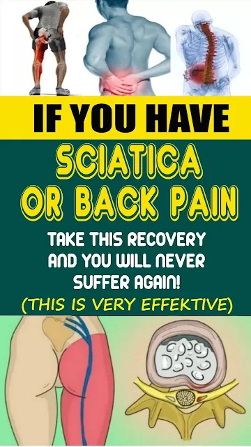 4 Awesome Home Remedies To Get Rid Of Sciatic Nerve Pain Fast