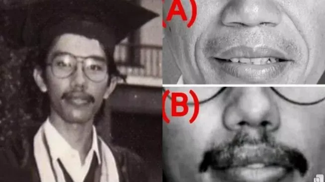 Mengejutkan! Pakai Ilmu Anatomi, Ahli Ungkap Foto Wisuda Jokowi Tak Serupa: Hidung, Bibir, dan Gigi Dua Orang Berbeda!