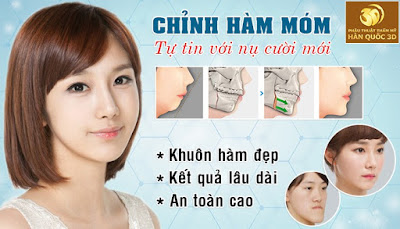 Phẫu thuật chỉnh hàm móm