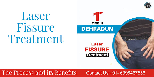 Laser Fissure Treatment
