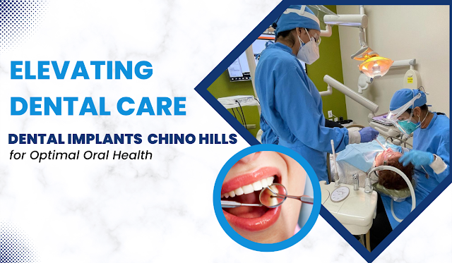 Dental Implants Chino Hills