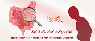 बच्चों बड़ों के पेट कीड़ों के लिए काल रूप यह घरेलू तरीके, Intestinal Worms Treatment in Hindi, pet ke kide marne ke upay, Pet ke Kide ka Gharelu Ilaj,, पेट कीड़े मिटाने के अचूक तरीके Intestinal Worms Treatment in Hindi