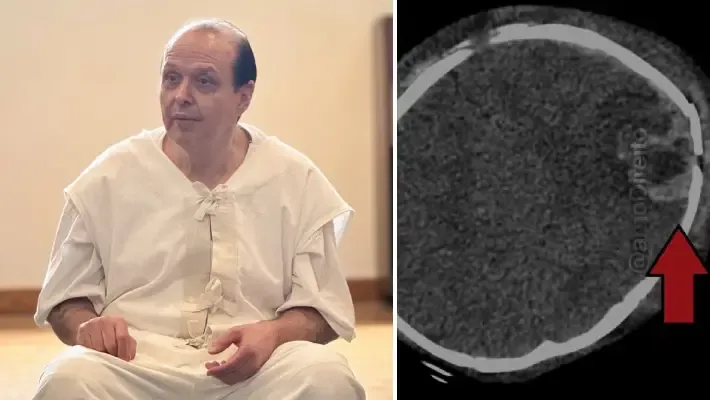 sindrome bebe sacudido levou pai corredor morte