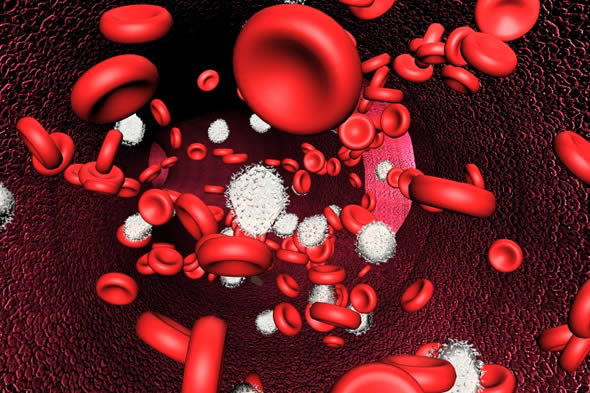 Liposomal Clodronate For Treating Autoimmune Hemolytic Anemia