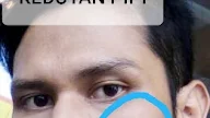 Arti Kedutan Pipi Kanan