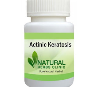 Herbal Product for Actinic Keratosis