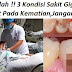 BERHATI-HATILAH 3 KONDISI SAKIT GIGI YANG TIDAK BOLEH KAMU TAHAN! "BISA MENYEBABKAN NYAWA MELAYANG"TOLONG SEBARKAN AGAR LEBIH BANYAK YANG TAHU AKAN BAHAYA INI !!!