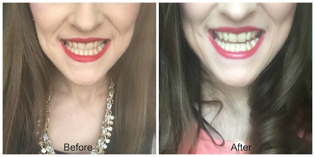 before and after richard marques strong teeth whitening toothpaste