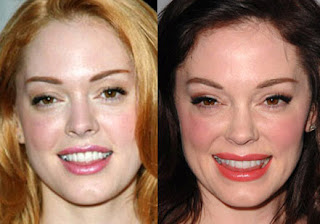Rose-McGowan-Plastic-Surgery-gone-bad-before-after