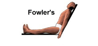 Fowler's position, Semi-fowler's, High-fowler's, Low-fowler's position