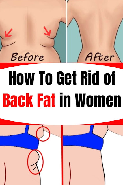 How To Get Rid of Back Fat in Women