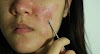 Are blackhead extractors safe to be used at home?