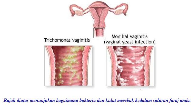 Ermayantizakaria: PREMIUM BEAUTIFUL I KEPUTIHAN