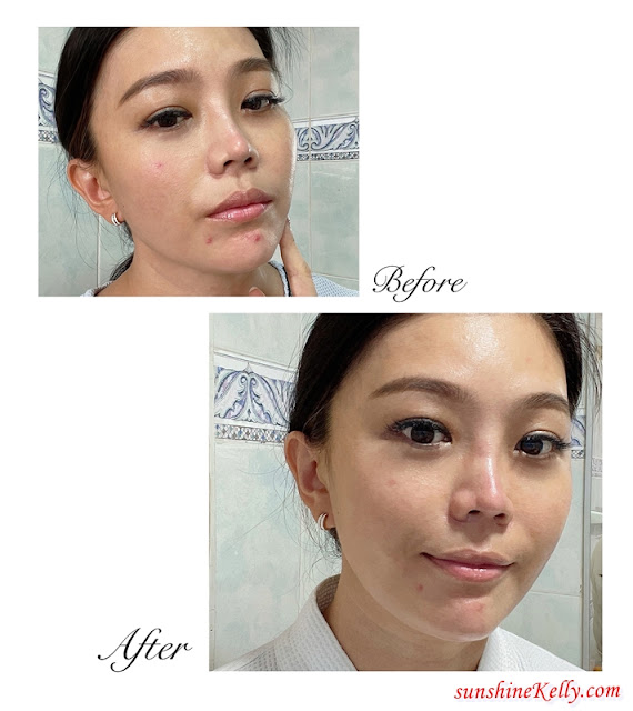 Review, My Maskne Skincare Journey,  Cetaphil PRO Acne Prone, Best Acne Skincare, Cetaphil, Maskne, Skincare Journey, Maskne Rescue, Beauty