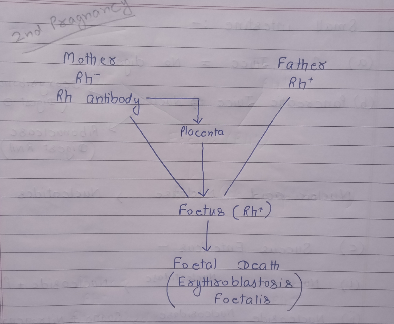 Erythroblastosis fetalis