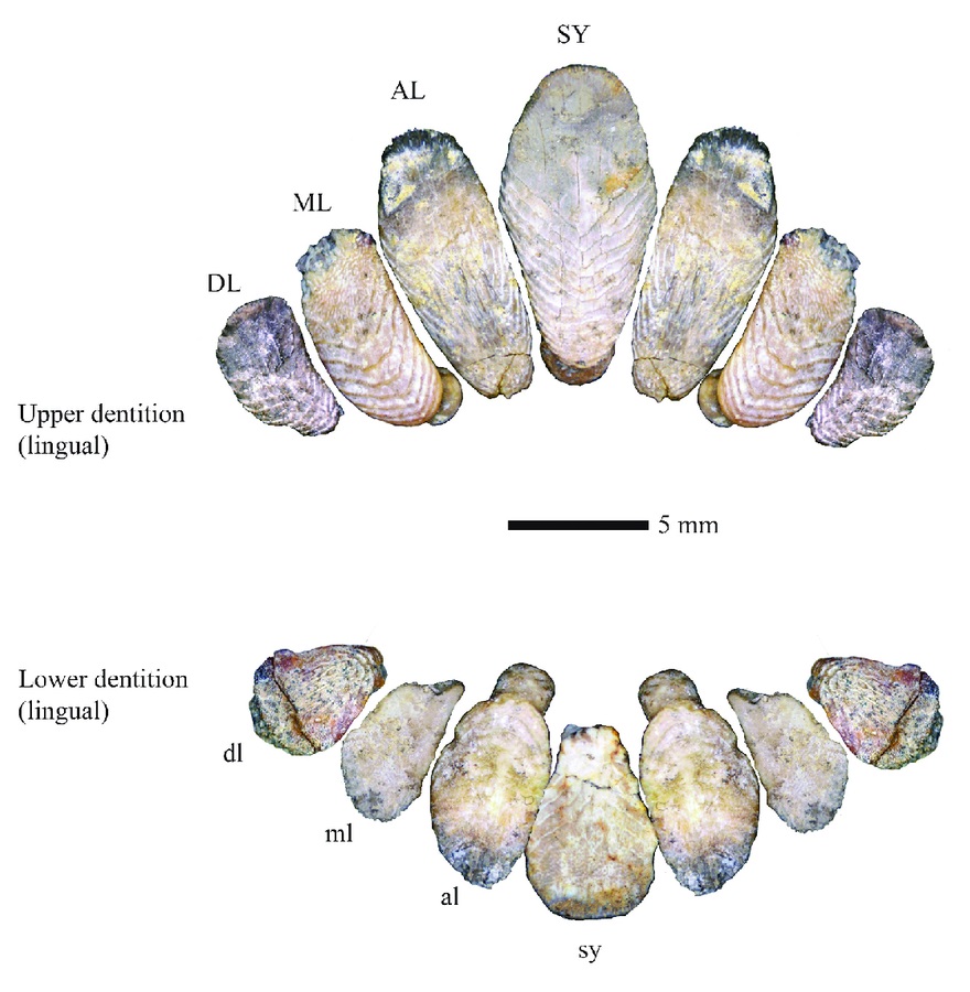 File:Apatinis žandikaulis, mandibula.jpg - Wikimedia Commons