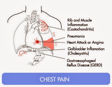 Chest Pain Left Side