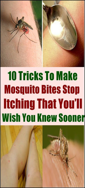 10 TRICKS TO MAKE MOSQUITO BITES STOP ITCHING THAT YOU’LL WISH YOU KNEW SOONER