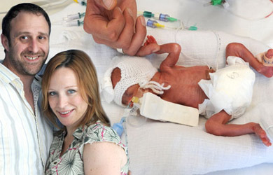 Kutipan Artikel Kesehatan: Ajaib, Bayi Kembar Prematur 23 