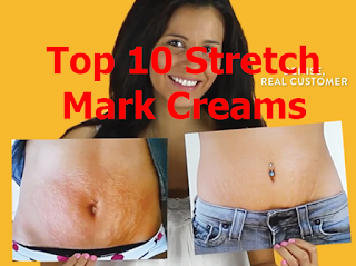 Top 10 stretch mark creams review