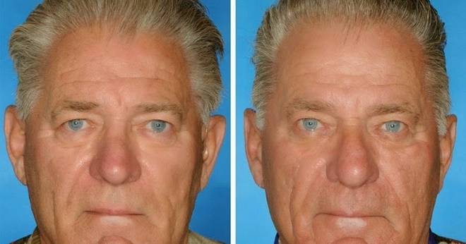 Here's What 7 Smoker VS. Non-Smoker Identical Twins Look Like After Years Of Lighting Up