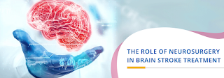 Stroke Interventions: The Role of Neurosurgery in Saving Lives