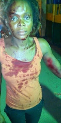 Omg! Couple Stap Neighbor 10 Times With Broken Bottle.. Details