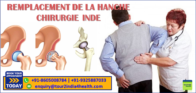 Tour2india4health veille à ce que ces patients soient bien traités. Nous vérifions la disponibilité des meilleures et des plus attractives offres relatives au remplacement d'une articulation de la hanche lors d'une chirurgie à faible coût en Inde...