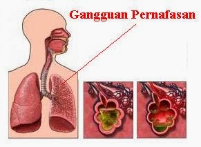 Gangguan penyakit pada alat pernapasan manusia