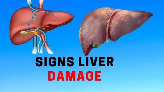 14 Signs Liver Damage