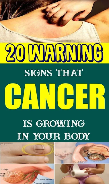 20 Warning Signs That Cancer Is Growing In Your Body