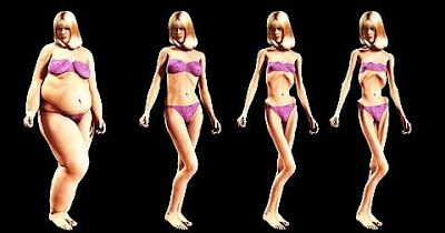  Anorexia nervosa Homeopathy Treatment in Chennai 