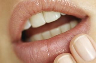 People who get cold sores may