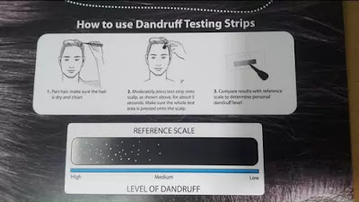 Dandruff and Heavy hair loss