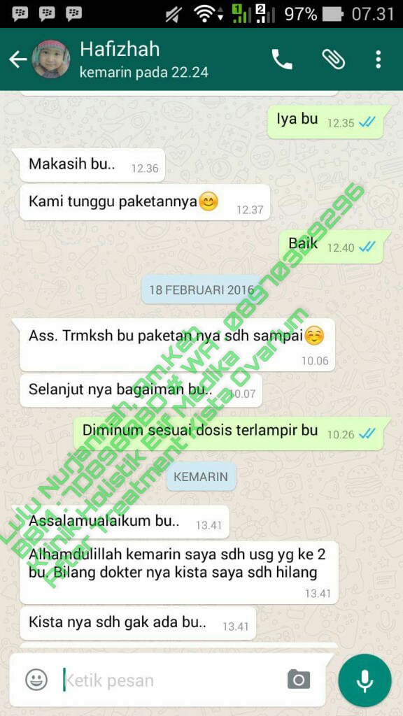 Testimoni Pasien Kista Ovarium Klinik  Holistik Elif Medika 