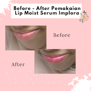 Review Implora Lip Moist Serum