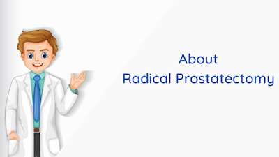 radical prostatectomy