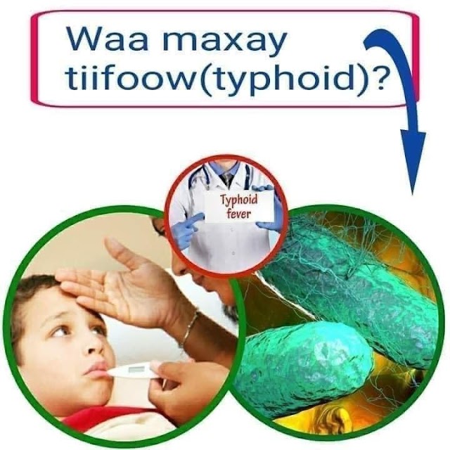 TYPHOID TIIFOOW