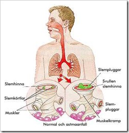 astma1