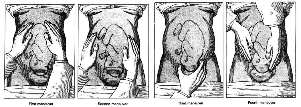 Normal+mechanism+of+labour