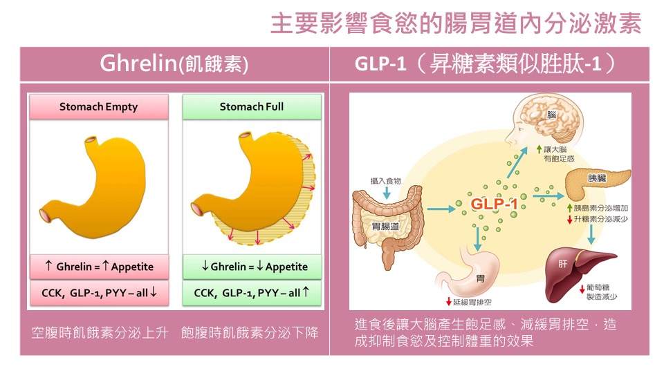 內視鏡減重 縮胃 控制食慾 胃內肉毒 縮胃針