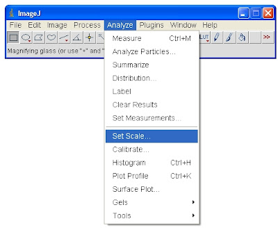 Skeptic Wonder Quick Imagej Tutorial Scalebar Calibration